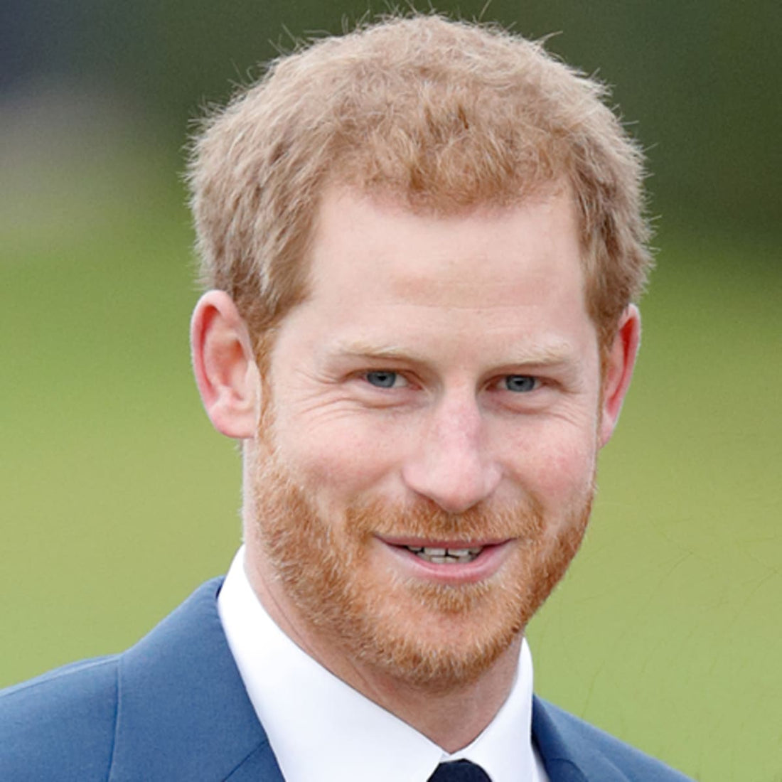 Prince Harry has type 1 skin 